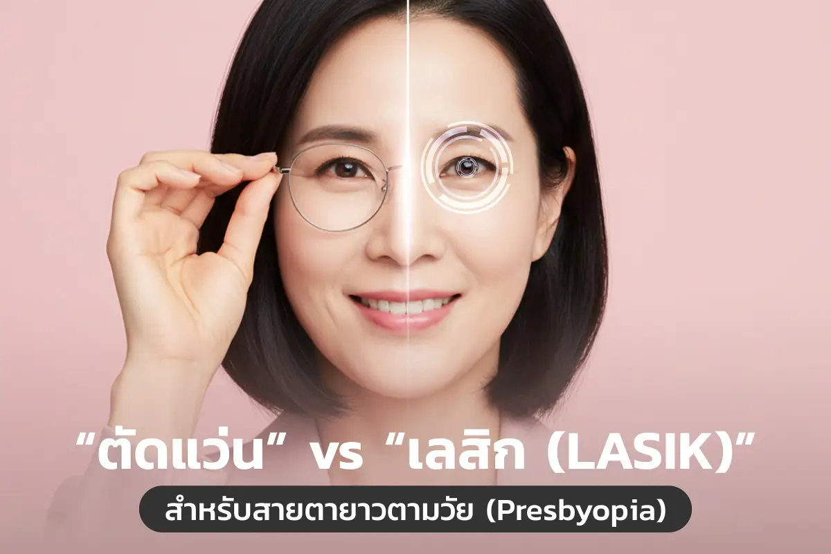  “ตัดแว่น” vs “เลสิก (LASIK) สำหรับสายตายาวตามวัย (Presbyopia)” 